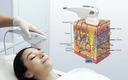 A comprehensive introduction of ultrasonic anti-wrinkle technology