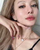 v beauty sydney lip filler