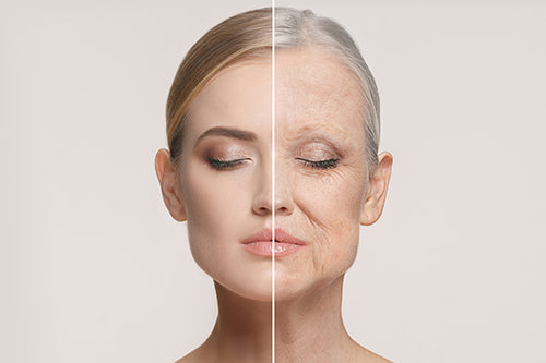 Ultrasonic anti-wrinkle technology is suitable for which groups of people?