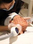 Thermage Skin Tightening: Your Complete Guide