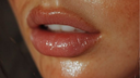 Lip Augmentation Consultation