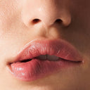 sydney lip filler price