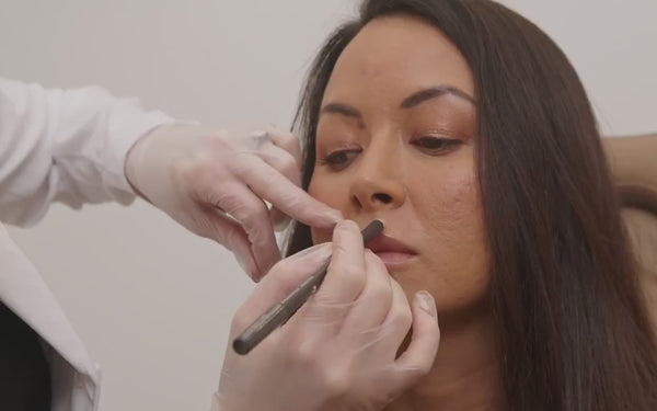 best lip filler in sydney