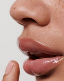 sydney best lip filler