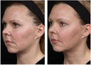 Before and after thermal treatment
