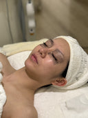 thermage treatment for eyes